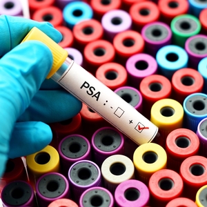 9 Ways to Lower and Manage Cortisol Levels